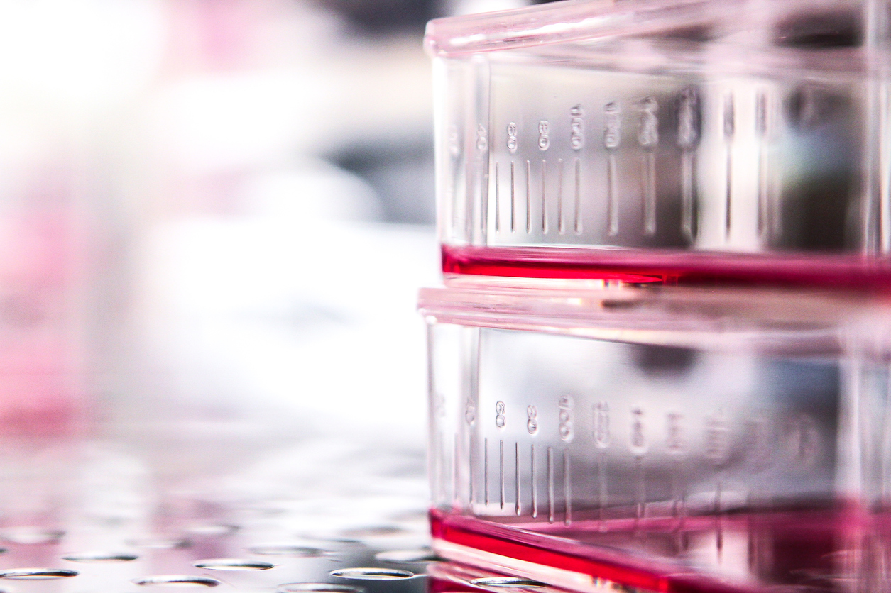 Key Factors and New Technologies to Consider when Purchasing a Cell Culture Incubator