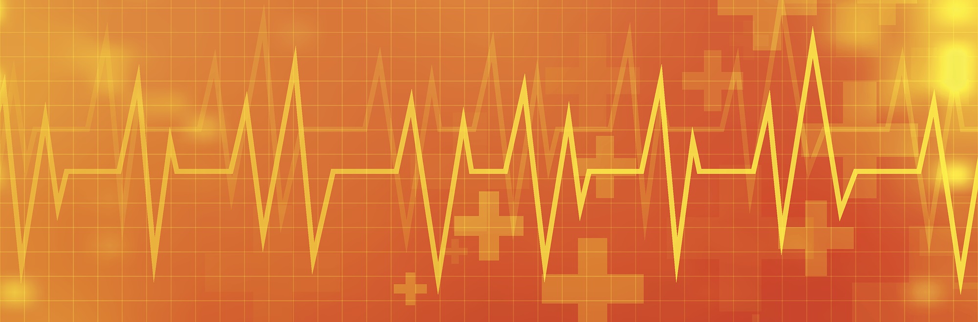 10 Important Factors in Choosing a Dealer for New or Refurbished Mass Spectrometers