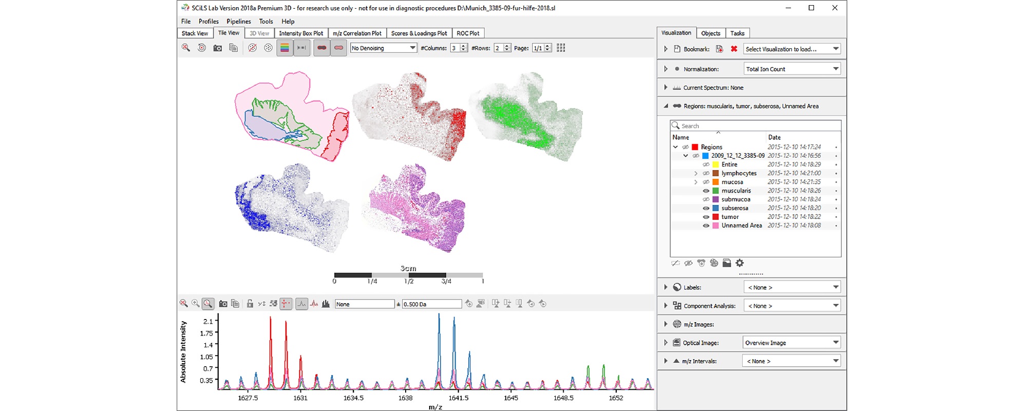 Bruker`s New Software and Informatics Solutions to Empower Metabolomics, Proteoform Profiling, and Toxicology