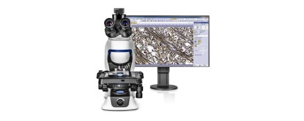Microscope Camera for Standard Brightfield Imaging