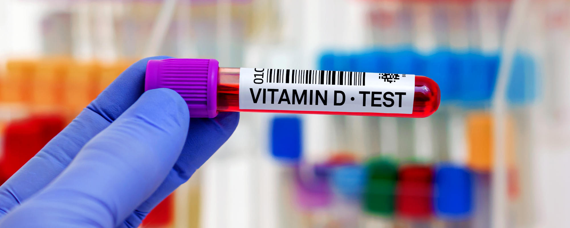 Shedding Light on Advances in Vitamin D Testing