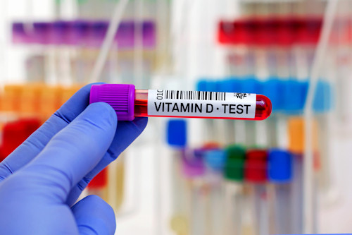 Shedding Light on Advances in Vitamin D Testing