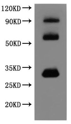 Recombinant Human Claudin-18.2(CLDN18.2)-VLPs (Active)