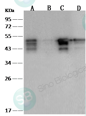 SARS-CoV / SARS-CoV-2 Nucleocapsid Antibody, Rabbit MAb