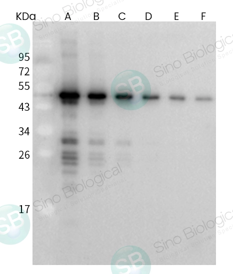 SARS-CoV / SARS-CoV-2 Nucleocapsid Antibody, Rabbit MAb