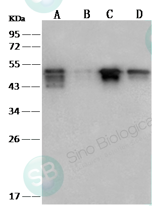 SARS-CoV / SARS-CoV-2 Nucleocapsid Antibody, Rabbit MAb