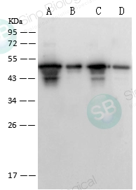 SARS-CoV / SARS-CoV-2 Nucleocapsid Antibody, Rabbit PAb, Antigen Affinity Purified