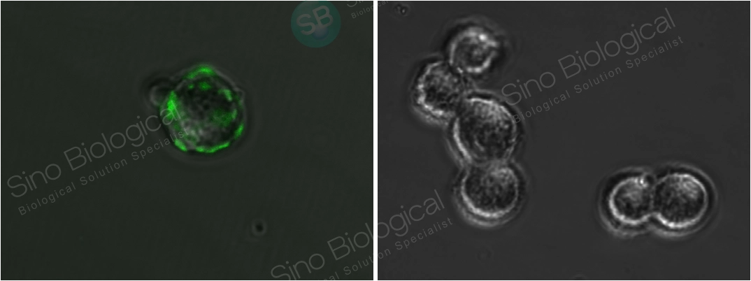 SARS-CoV / SARS-CoV-2 Spike antibody, Chimeric MAb