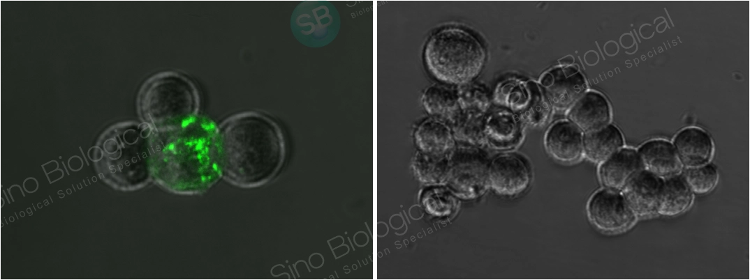 SARS-CoV / SARS-CoV-2 Spike Antibody, Rabbit MAb