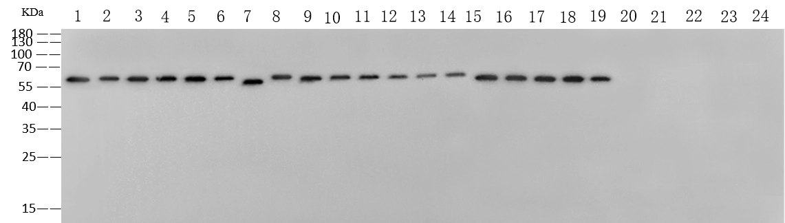 Pan Influenza A Nucleoprotein Antibody, Mouse MAb