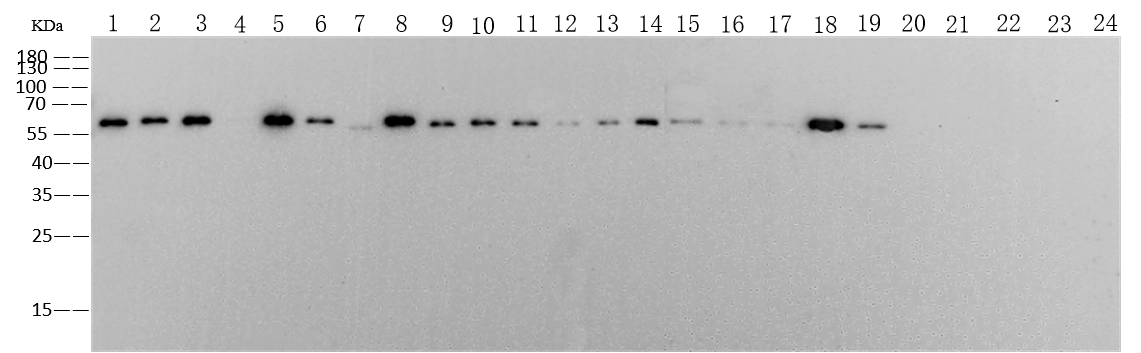 Pan Influenza A Nucleoprotein Antibody, Mouse MAb