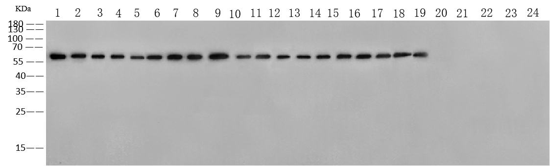 Pan Influenza A Nucleoprotein Antibody, Rabbit MAb