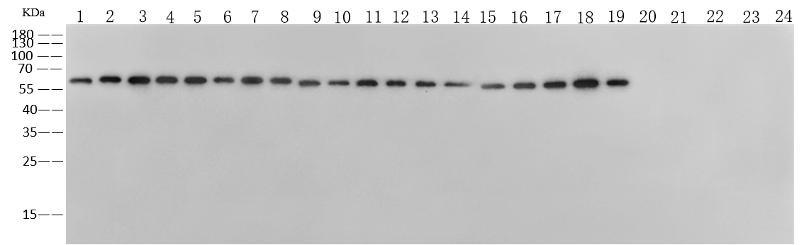 Pan Influenza A Nucleoprotein Antibody, Rabbit MAb