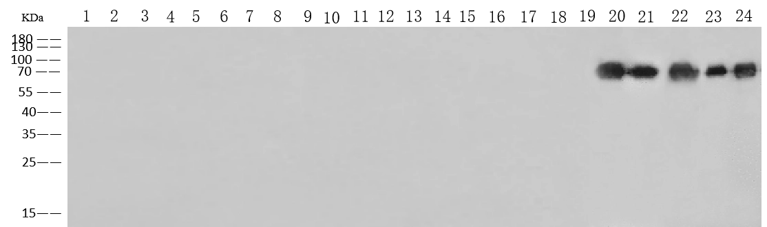 Pan Influenza B Nucleoprotein Antibody, Mouse MAb