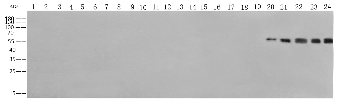 Pan Influenza B Nucleoprotein Antibody, Mouse MAb