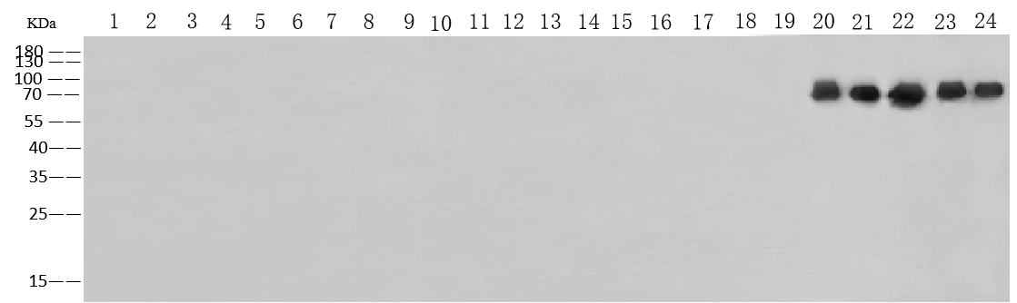 Pan Influenza B Nucleoprotein Antibody, Rabbit MAb