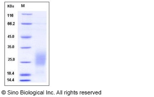 Human GM-CSF / CSF2 Protein (His Tag)