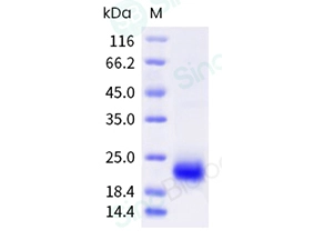 Human VEGF-D / VEGFD / FIGF Protein (His Tag)