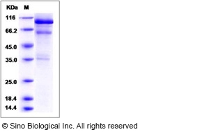 Mouse HGF / Hepatocyte Growth Factor Protein