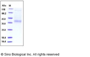 Mouse IL-34 Protein (His Tag)