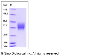 Mouse Oncostatin M / OSM Protein (His Tag)