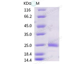 Mouse OX40L / TNFSF4 Protein (ECD, His Tag)