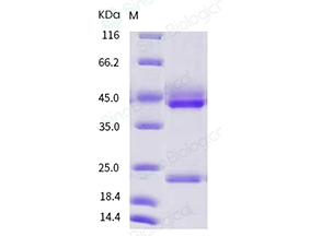 Human IL-23 (IL23A & IL12B Heterodimer) Protein (His Tag)