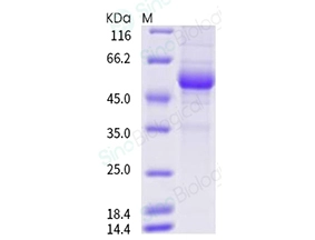 Human RANKL / OPGL / TNFSF11 / CD254 Protein (ECD, Fc Tag)