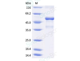 Human TNFSF9 / 4-1BBL / CD137L Protein (Fc Tag, ECD)