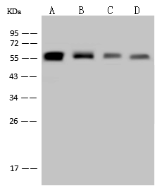 Vimentin/VIM Antibody, Rabbit MAb