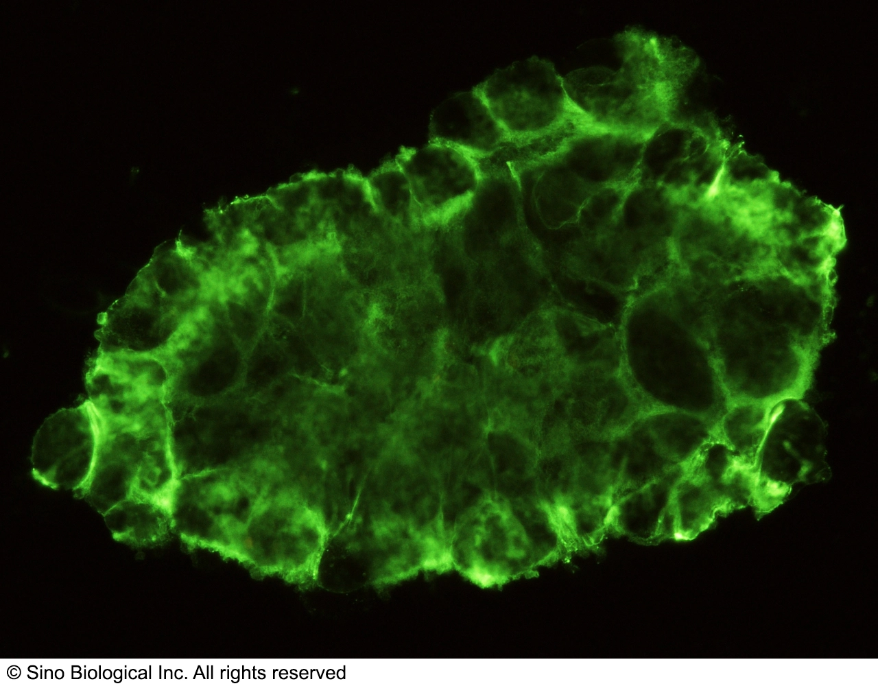 CD31 / PECAM-1 Antibody, Rabbit MAb