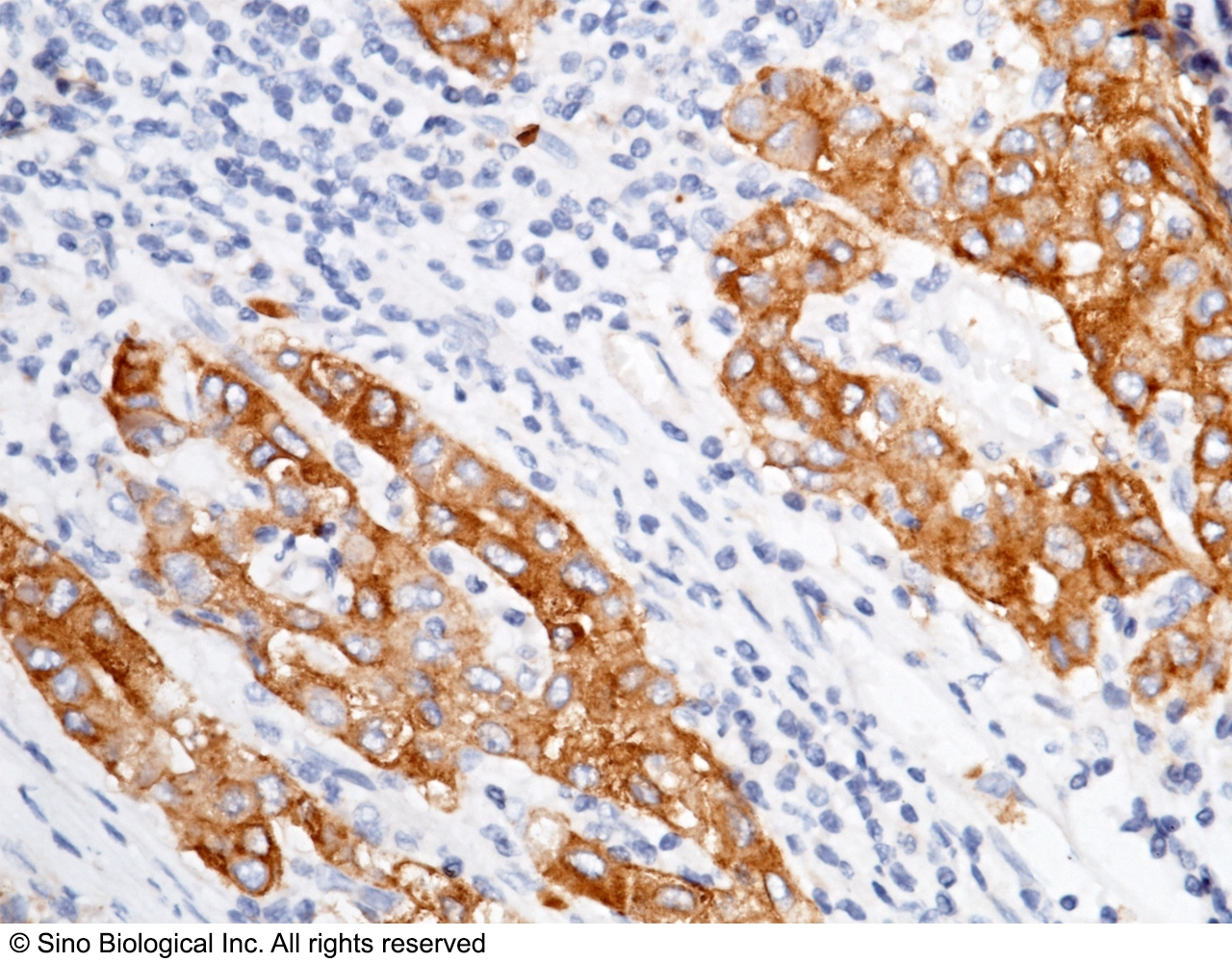 ASGPR1 / ASGR1 Antibody, Rabbit PAb, Antigen Affinity Purified