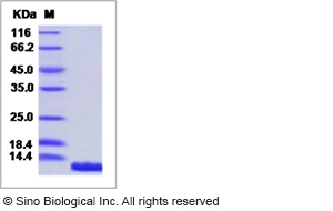 Human IL-8 / CXCL8 Protein (His Tag)