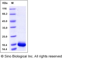 Human IL36G / IL1F9 Protein (aa 18-169, His Tag)