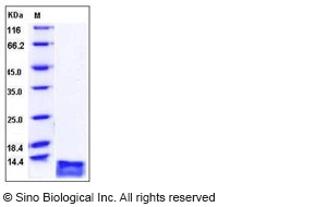 Human CCL17 / TARC / SCYA17 Protein (His Tag)