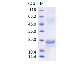 Human TNFSF14 / LIGHT / CD258 Protein (His Tag)