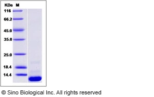 Human CCL20 / MIP-3 alpha Protein (His Tag)