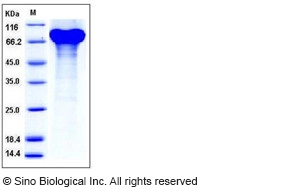 Mouse Progranulin Protein (His Tag)