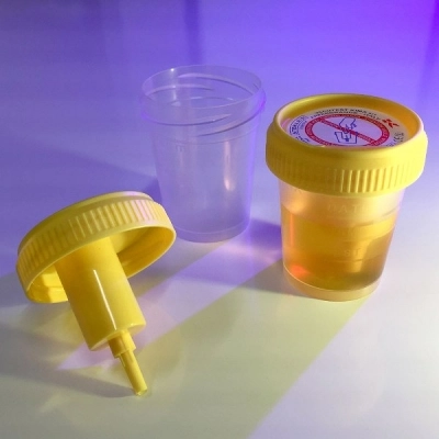 Globe Scientific 60mL, 2oz Urine Collection Cup with Integrated Transfer Device STERILE CS/500 3852