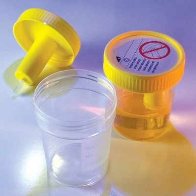 Globe Scientific 120mL, 4oz Urine Collection Cup with Integrated Transfer Device CS/300 3856L