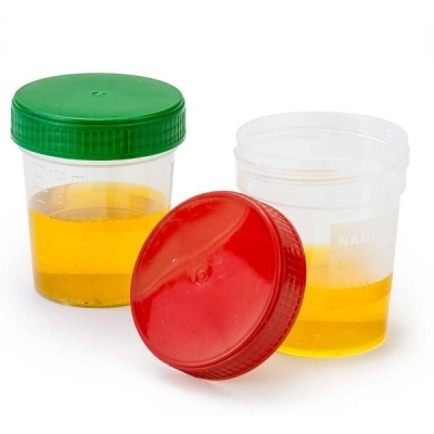 Globe Scientific 4oz Specimen Container with Full Turn Green Separate Screwcap, CS/500 5905G