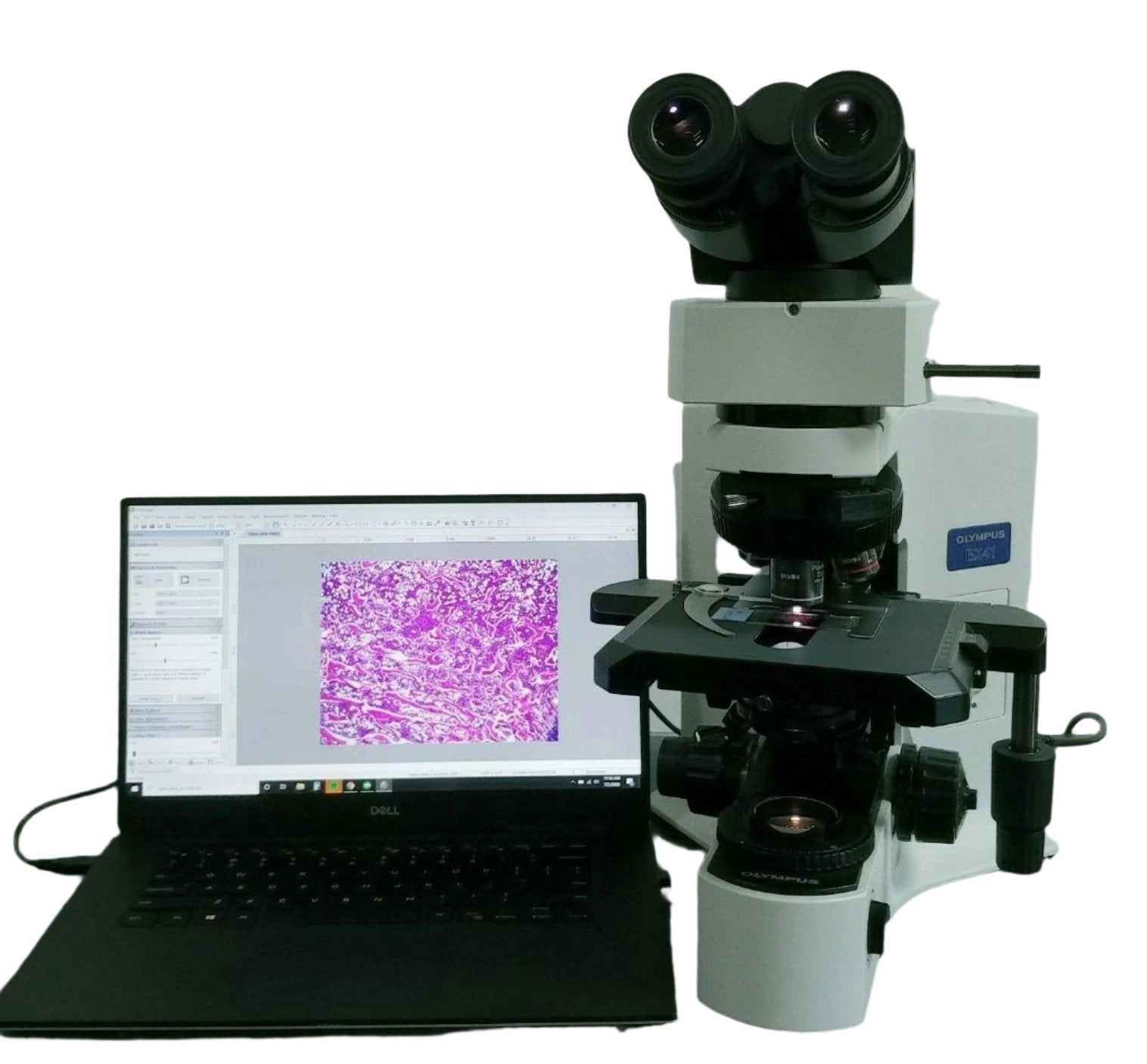 Olympus Microscope BX41 with 2x Apo and Fluorite Objectives and 10 MP Camera