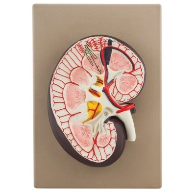 Eisco Human Kidney Cross Section Model - 3X Life Size AM0106