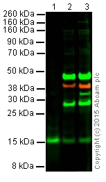 Anti-BDNF antibody [EPR1292]