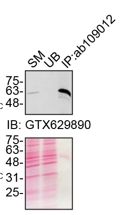 Anti-SQSTM1 / p62 antibody [EPR4844] - Autophagosome Marker