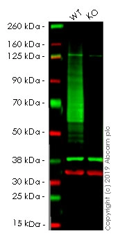 Anti-Glucose Transporter GLUT1 antibody [EPR3915]