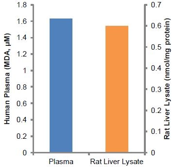 Lipid Peroxidation (MDA) Assay Kit