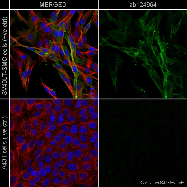 Anti-alpha smooth muscle Actin antibody [EPR5368]