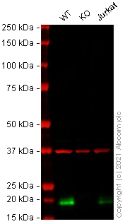 Anti-Glutathione Peroxidase 4 antibody [EPNCIR144]