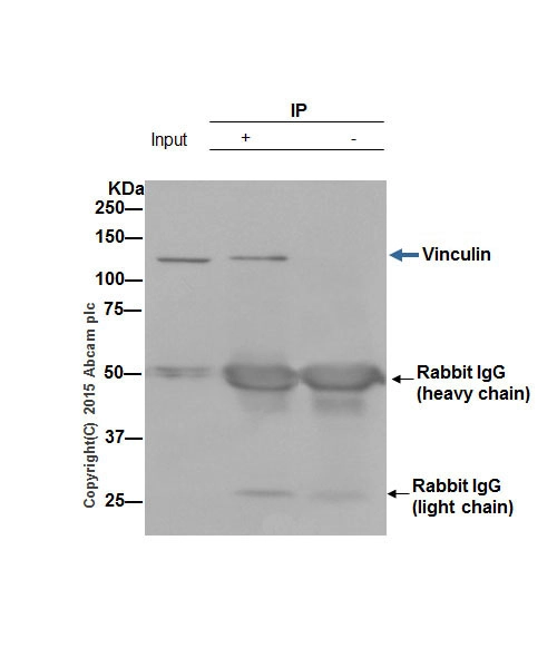 Anti-Vinculin antibody [EPR8185]